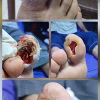 کارشناس و درمانگر زخم