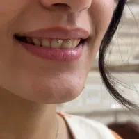 انجام خدمات تتو بدن و پیرسینگ