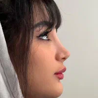 جراحی.بینی|خدمات آرایشگری و زیبایی|اراک, |دیوار