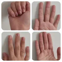 اگه قند داری چربی داری کلی مشکلات بیا|آرایشی، بهداشتی، درمانی|رشت, کوی حسینی|دیوار