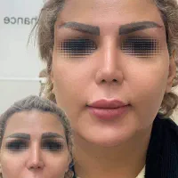 مطب زیبایی پوست و مو و جوانسازی پوست تجریش