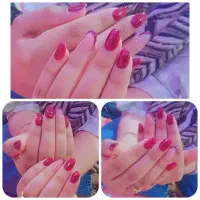 کاشت ناخن