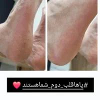 پدیکور و کف سابی|خدمات آرایشگری و زیبایی|رشت, بوسار|دیوار
