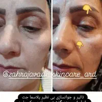 تخفیف روز مادر