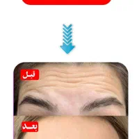 هایفو7 بعدی کل صورت999 هزارتومن|خدمات آرایشگری و زیبایی|اهواز, نادری|دیوار