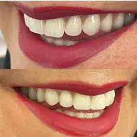 مرکزفوق تخصصی ایمپلنت دیجیتال/فوری/سبک کاخ لبخند