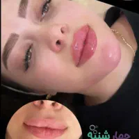 زل صورت|خدمات آرایشگری و زیبایی|بوئین زهرا, |دیوار