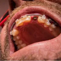 دندانپزشکی ایمپلنت+لمینت+کامپوزیت+ارتودنسی اقساط|خدمات آرایشگری و زیبایی|مشهد, سجاد شهر|دیوار
