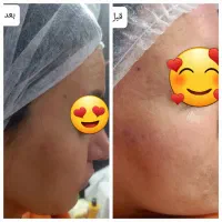 فشیال و خدمات جوانسازی ارغوان فقط دویست هزار تومان|خدمات آرایشگری و زیبایی|نیشابور, دارایی|دیوار
