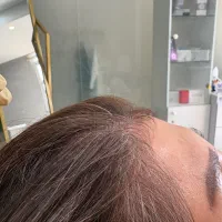 تخفیفات فوق العاده در کلینیک پوست ومو|خدمات آرایشگری و زیبایی|اندیشه, اندیشه فاز ۶|دیوار