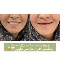 دندانسازی نیکو|خدمات آرایشگری و زیبایی|الوند, |دیوار