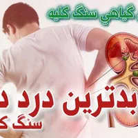 درمان سنگ کلیه به روش کاملا گیاهی