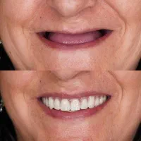 کره ای درجه یک