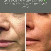 پوستت لایق یه تغییر خاصه