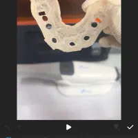 ایمپلنت دیجیتال|خدمات آرایشگری و زیبایی|قم, نیروگاه|دیوار