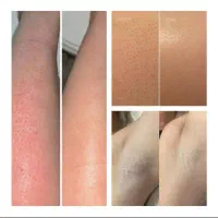 لیزر موهای زائد بدون درد -قیمت استثنایی 260ت|خدمات آرایشگری و زیبایی|ری, دولت‌آباد|دیوار