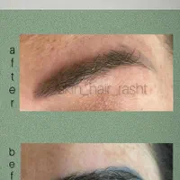 مرکز مراقبت پوست مو لاغری رشت|خدمات آرایشگری و زیبایی|رشت, گلباغ نماز|دیوار