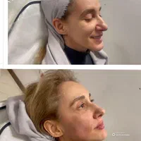کلینیک پوست مو و زیبایی آراد سهروردی شمالی|خدمات آرایشگری و زیبایی|تهران, سهروردی|دیوار
