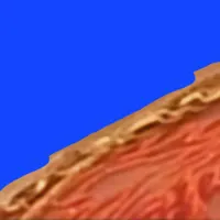 گمشدن گردنبند طلا