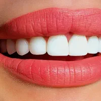 خدمات دندانپزشکی|خدمات آرایشگری و زیبایی|پارسآباد, |دیوار