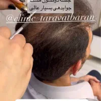 لیزر موهای زائد پی‌آر‌پی هایفو حجم‌سینه‌باسن لاغری|خدمات آرایشگری و زیبایی|تهران, صادقیه|دیوار