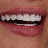 استخدام حسابدار خانم یا اقا مسلط به هلو و سپیدار