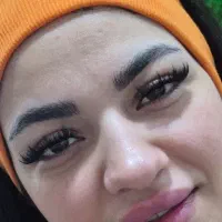 کاشت مژه کایلی