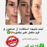 بمب سفیدی|آرایشی، بهداشتی، درمانی|مراغه, |دیوار