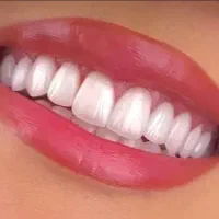 باعکسOPG،بیمه تکمیلی سامان ویاچک صیادی مراجعه کنید|خدمات آرایشگری و زیبایی|بم, |دیوار