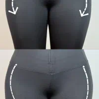 فیلربادی با تخفیف ۵۰٪در کلینیک مهرزاد|خدمات آرایشگری و زیبایی|تهران, جردن|دیوار