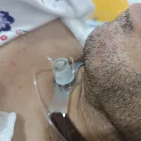 پرستاری در منزل