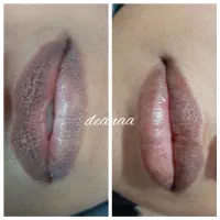 شیدلب.رفع تیرگی.فشیال تخصصی.آموزش.پیراپزشک هستم|خدمات آرایشگری و زیبایی|زاهدان, |دیوار