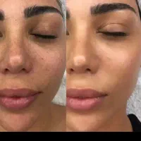 سالن زیبایی در دولت اباد|خدمات آرایشگری و زیبایی|کرمانشاه, |دیوار