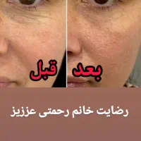 محصولات جوانساز شرکت بازیابان ایران زمین|آرایشی، بهداشتی، درمانی|اشتهارد, |دیوار