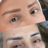 اصلاح فرم و بدرنگی تاتو ابرو بدون ریموو