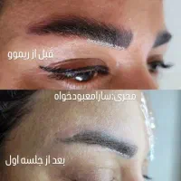 ریمووپاک کردن تتوتاتوابروصورت بدن