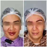 جشنواره  زیبایی کلینیک دکتر محمودی|خدمات آرایشگری و زیبایی|کرمان, |دیوار