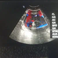 آموزش و طراحی نیاز