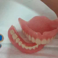 دندانپزشکی با بیمه تکمیلی و آزاد / بدون پیش