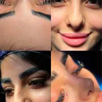 تخفیف۱۵میلیونی جشنواره عیدانه عمل جراحی بینی|خدمات آرایشگری و زیبایی|کرج, اصفهانیها|دیوار