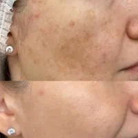 این آگهی رو از دست نده