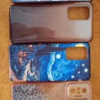 قاب گوشی شیائومی ردمی نوت 10