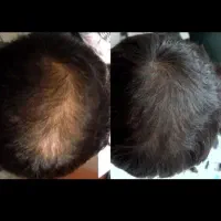دوست داری جذاب باشی راه حلت پیش ماست