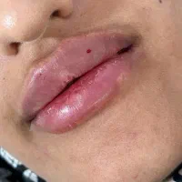 تخفیف ۵۰ درصدی کلینیک آیسان