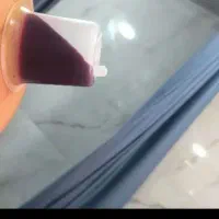 حجامت و زالو درمانی