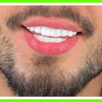 دندانپزشکی عصبکشی/کامپوزیت/پالیش/ترمیم/شرق و غرب|خدمات زیبایی و سلامت|تهران, تهرانپارس شرقی|دیوار