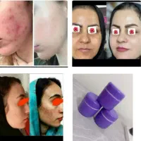 ارسال رایگان|آرایشی، بهداشتی، درمانی|خاش, |دیوار