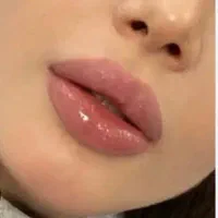 انجام خدمات زیبایی ،بوتاکس ،فیلر،مروتراپی ،مزوژل و|خدمات آرایشگری و زیبایی|تهران, نیروی هوایی (پیروزی)|دیوار