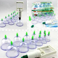 انواع حجامت و بادکش و فصد خون در مطب و در منزل|خدمات آرایشگری و زیبایی|پاکدشت, پاکدشت (مامازند)|دیوار