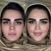 جشنواره  فیلر بیکینی مدلینگ ،بوتاکس ،شقیقه زیر چشم|خدمات آرایشگری و زیبایی|تهران, اختیاریه|دیوار